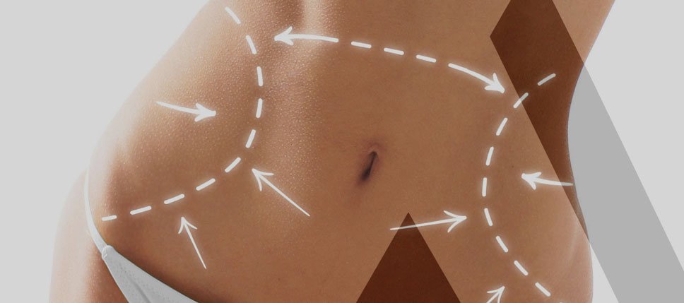 belly-liposuction-Turkey